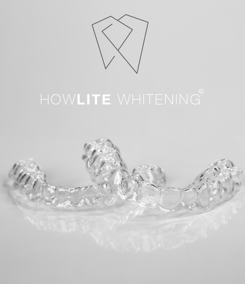 HowLite Whitening